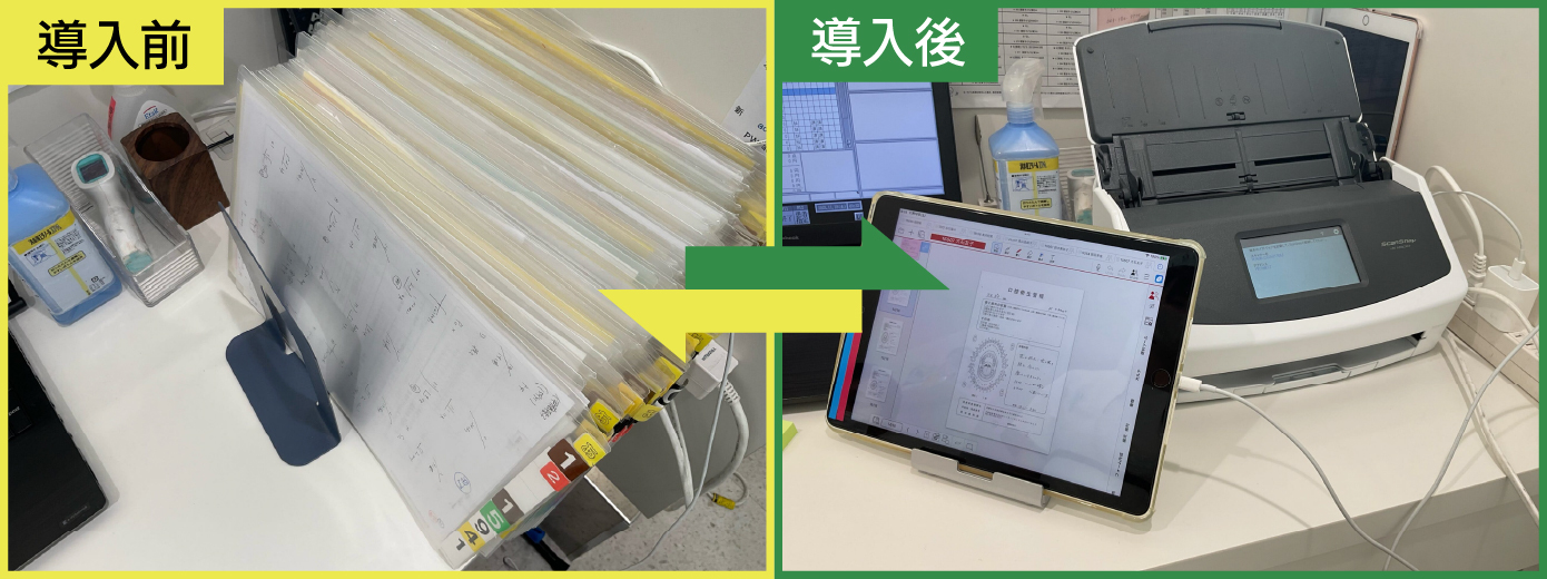 beforeafter